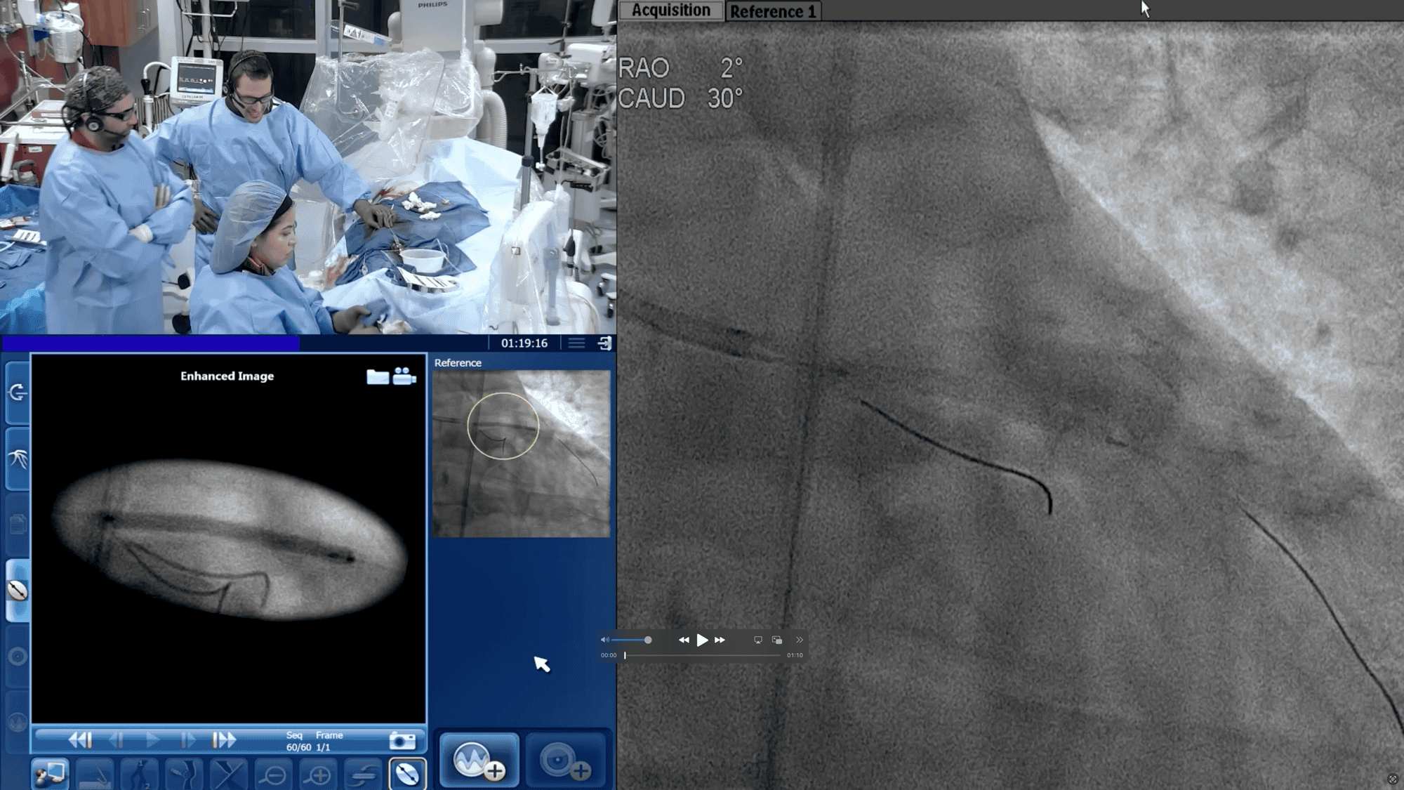 Screenshot from ACIST’s Portfolio Usefulness in the  Cath Lab video